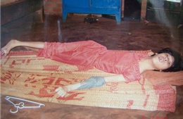  Chất độc da cam và nỗi đau hậu chiến - Kỳ 3